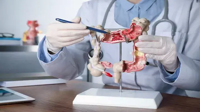 5 أطعمة تعزز صحة الأمعاء والجهاز الهضمي