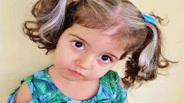 7 أسباب للشيب المبكر لدى الأطفال.. بينها تدخين الآباء