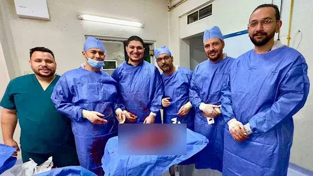 وزنه 16 كيلو.. فريق طبي ينجح في استئصال ورم ضخم من مريض بالفيوم
