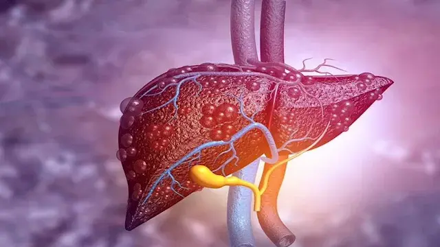 7 عادات تساعد على حماية الكبد من التلف