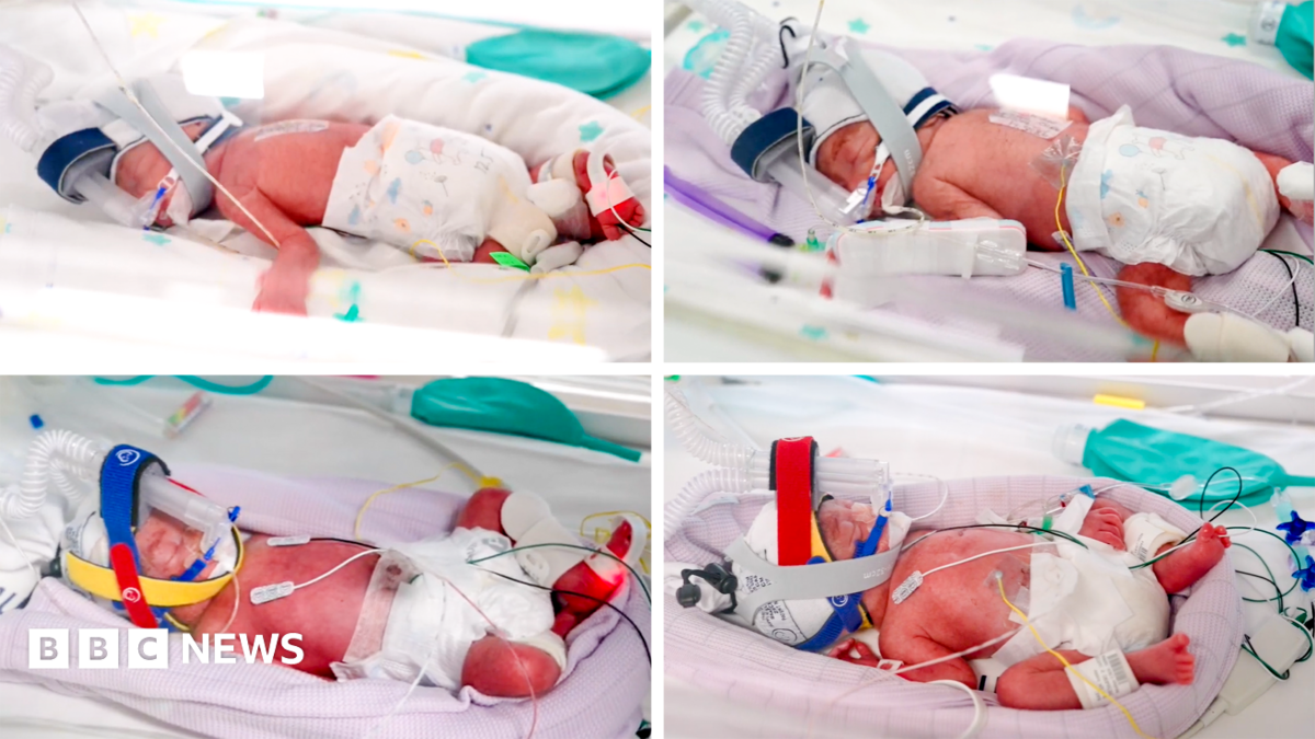 Rare identical quadruplets born in Australia