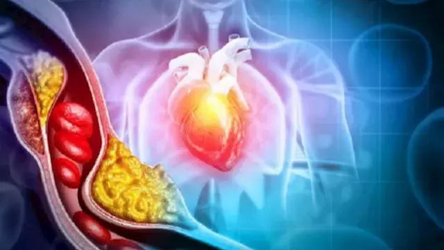 روتين مسائي لمحاربة القاتل الصامت .. أحرص على 5 عادات