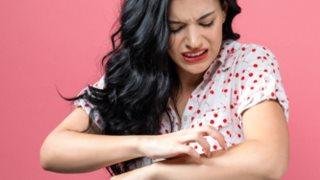 علاج حساسية الجلد في الصيف.. خطوات بسيطة لتخفيف الأعراض