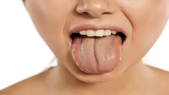 5 أسباب تجعلك تستيقظ بفم جاف صباحًا