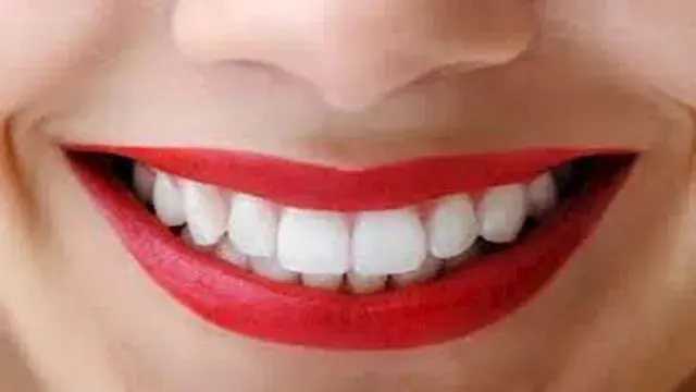 لماذا يتغير لون الأسنان؟.. أسباب التصبغات وطرق التخلص منها