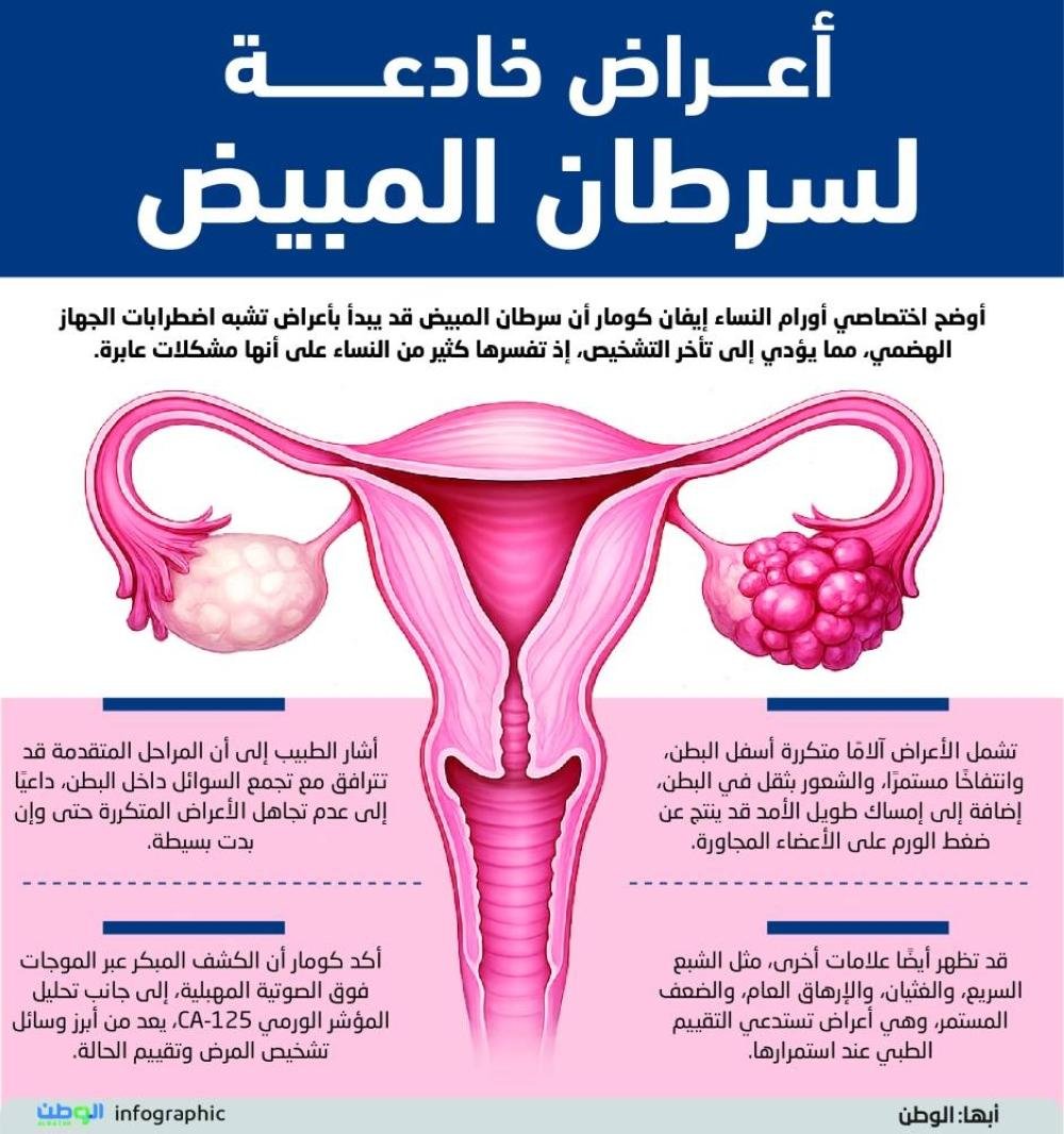 أعراض خادعة لسرطان المبيض