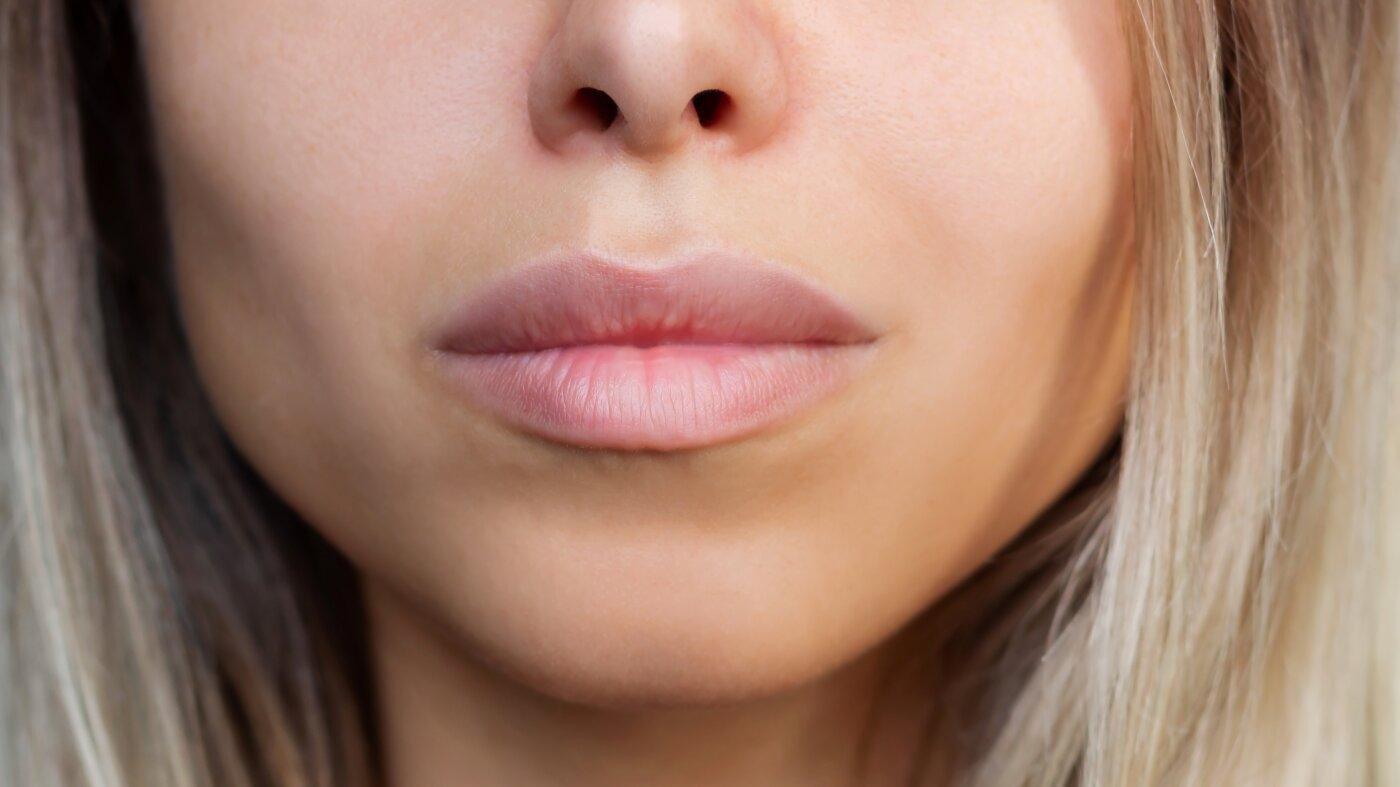 In pursuit of 'Instagram face,' are we losing the imperfections that make us human?