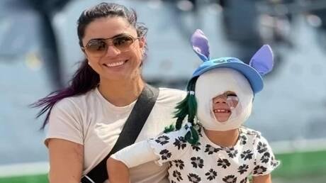 بعد رفض علاجها في أمريكا.. "طفلة قناع باتمان" تقترب من التعافي الكامل في روسيا