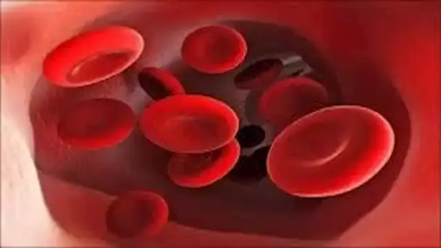 أخطاء قد تقلل من امتصاص مكملات الحديد
