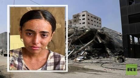 مأساة طفلة في غزة.. ميس القدرة تحاصرها الشمس والحرب وكلمات الناس والمرض (صورة + فيديو)
