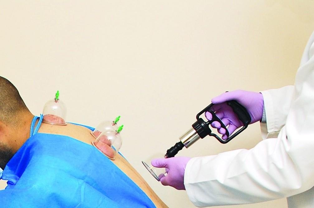 فئات لا تناسبها الحجامة.. أخصائية تحذر وتكشف معلومة هامة بشأن الأطفال